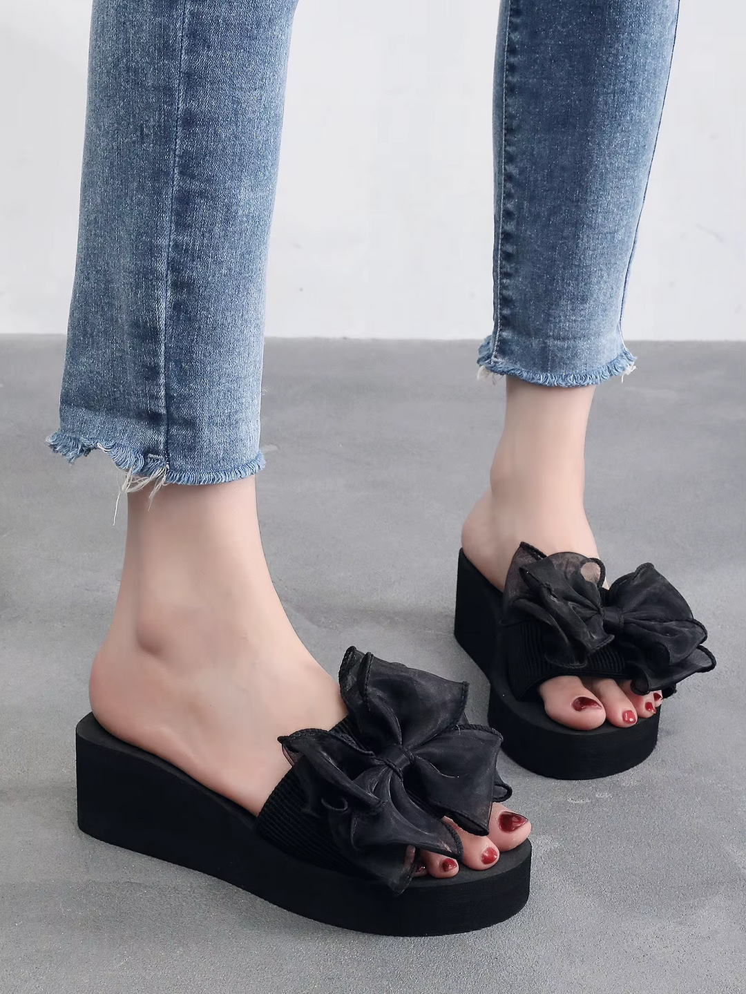 Mireia® - Orthopaedic Sandals | Premium Edition